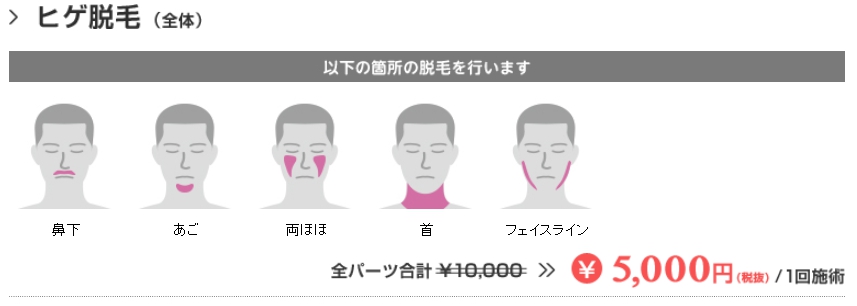 (ヒゲ脱毛写真)